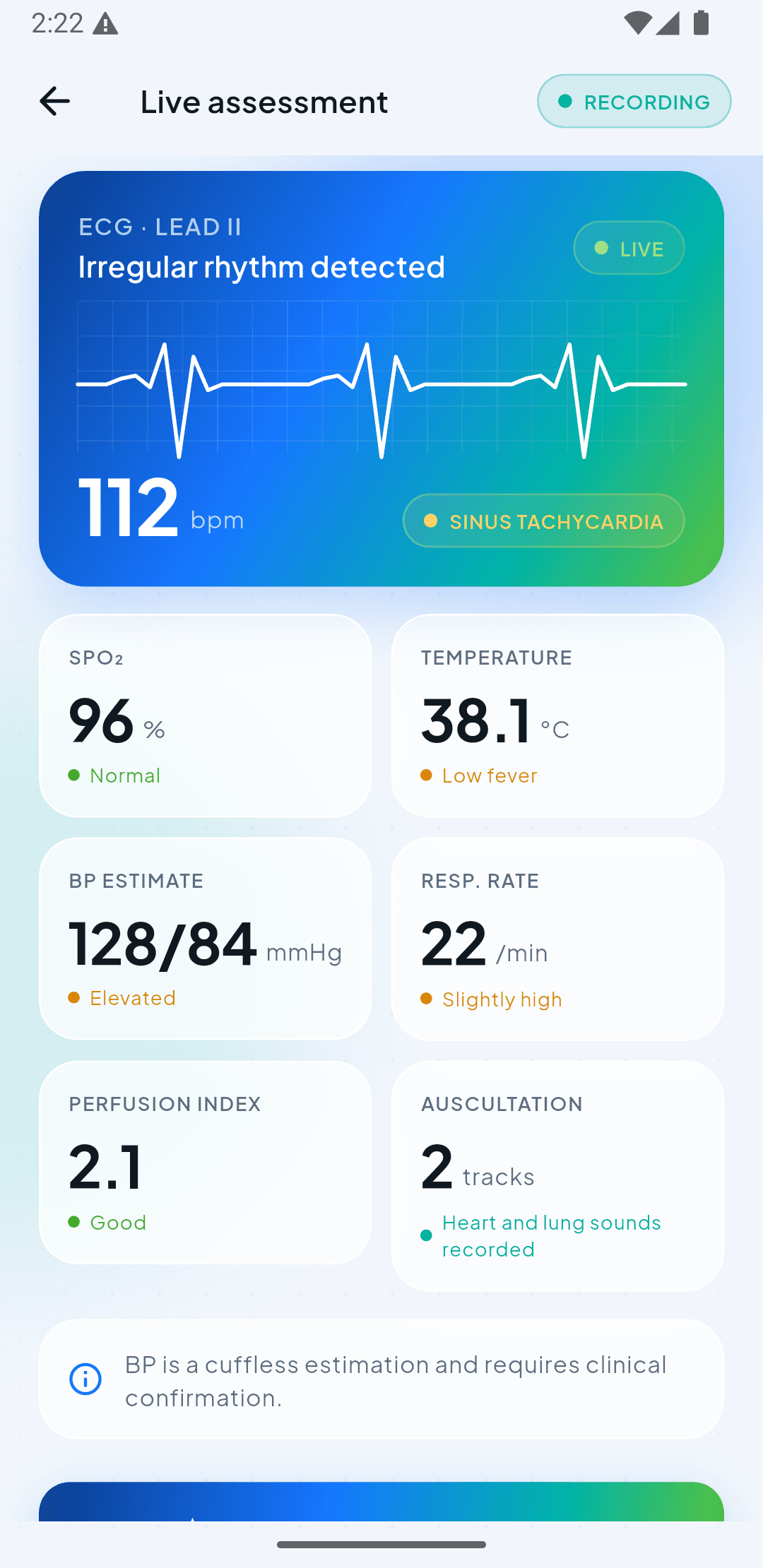 Medivue live assessment application showing connected physiological signals